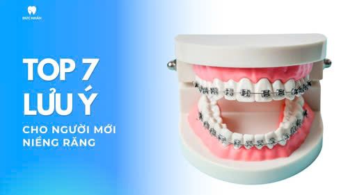 Top 7 điều cần lưu ý cho người mới niềng răng